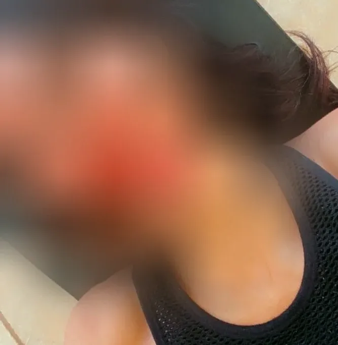 Anisa, 29 anni